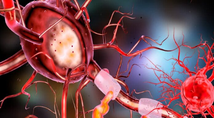 The Rosehip Neuron In The Human Brain