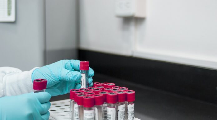The EPA’s Response To The Reedley Illegal Biolab With Chinese Links