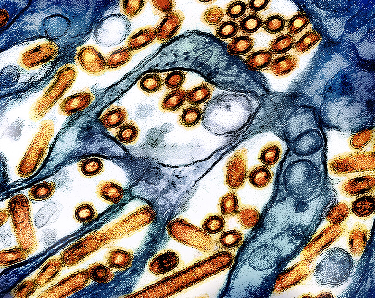 Europe Expands Poultry Restrictions as Bird Flu Cases Rise