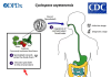 Cyclosporiasis Cases Rise Across the U.S. as Investigation Continues