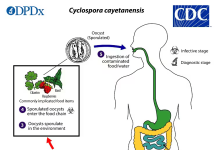 Cyclosporiasis Cases Rise Across the U.S. as Investigation Continues