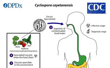 Cyclosporiasis Cases Rise Across the U.S. as Investigation Continues