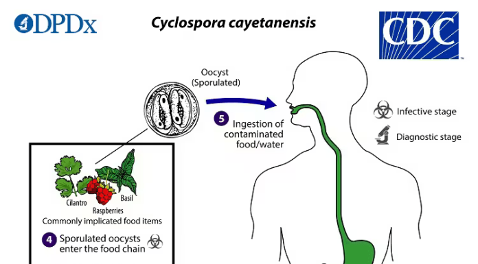 Cyclosporiasis Cases Rise Across the U.S. as Investigation Continues