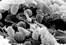 Mystery Death at Russian Plague Lab Raises Questions About What Killed Worker