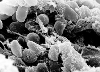 Mystery Death at Russian Plague Lab Raises Questions About What Killed Worker