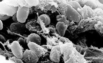 Mystery Death at Russian Plague Lab Raises Questions About What Killed Worker