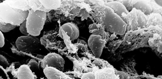 Mystery Death at Russian Plague Lab Raises Questions About What Killed Worker