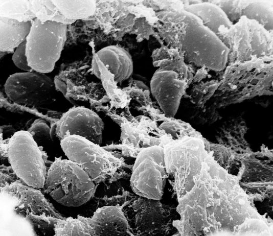 Mystery Death at Russian Plague Lab Raises Questions About What Killed Worker
