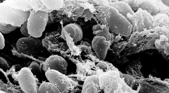 Mystery Death at Russian Plague Lab Raises Questions About What Killed Worker